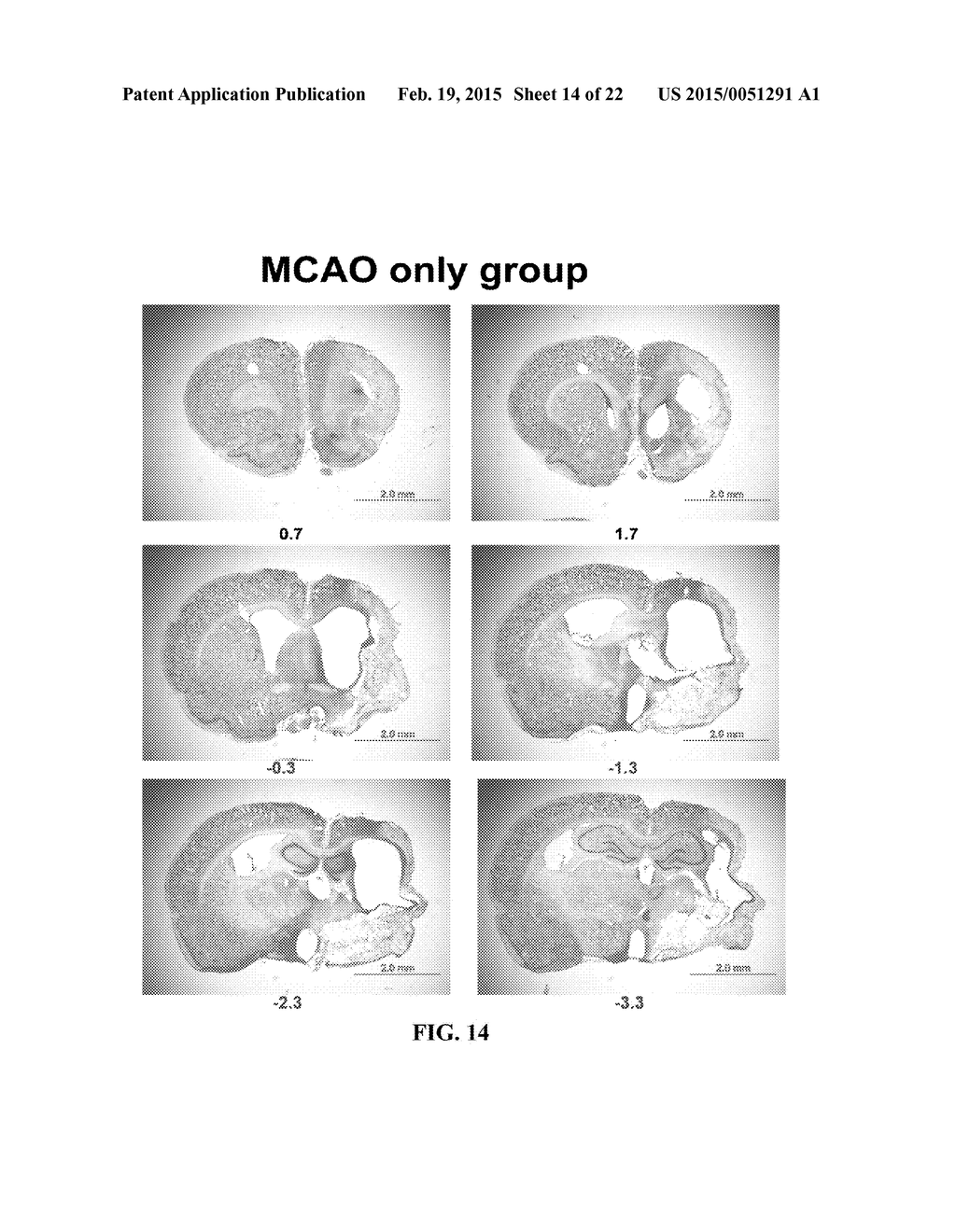 N,N'-DI-1 NAPHTHYLGUANIDINE HCL (NAGH) AND N,N'-DI-P-NITROPHENYLGUANIDINE     HCL (NAD) TREATMENT FOR STROKE AT DELAYED TIMEPOINTS - diagram, schematic, and image 15