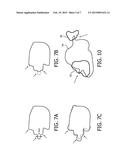 METHOD FOR REGULARIZING APERTURE SHAPE FOR MILLING diagram and image