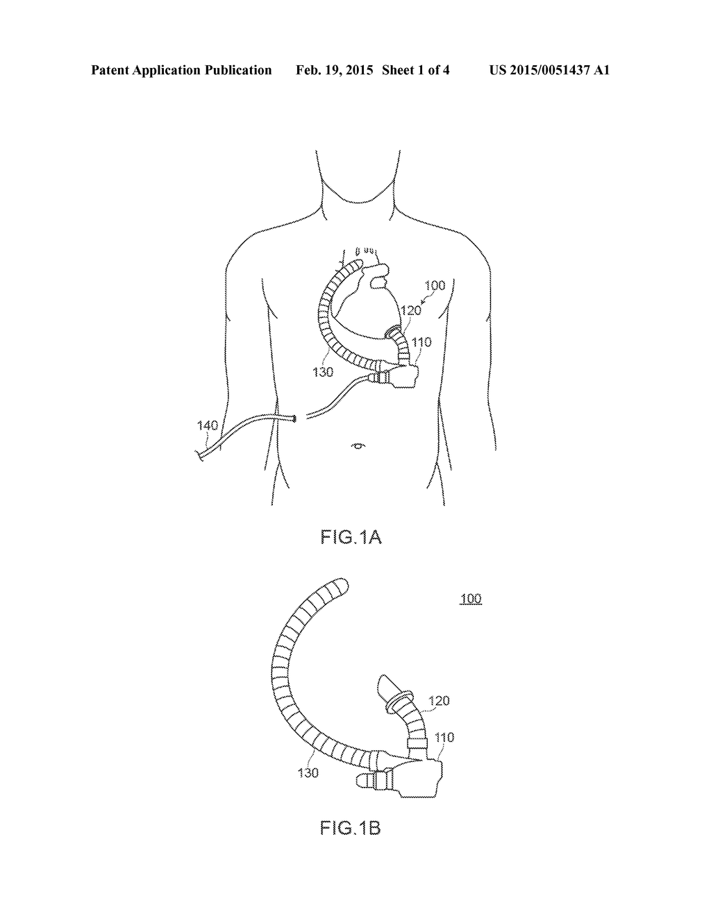 VENTRICULAR ASSIST SYSTEM - diagram, schematic, and image 02