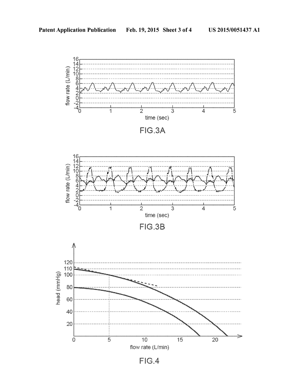 VENTRICULAR ASSIST SYSTEM - diagram, schematic, and image 04