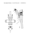 EXTENSIONLESS REVERSIBLE CONNECTION CATHETER APPARATUS diagram and image