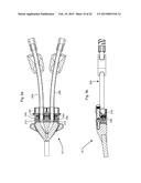 EXTENSIONLESS REVERSIBLE CONNECTION CATHETER APPARATUS diagram and image