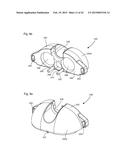 EXTENSIONLESS REVERSIBLE CONNECTION CATHETER APPARATUS diagram and image