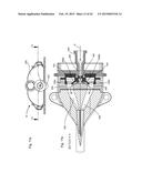 EXTENSIONLESS REVERSIBLE CONNECTION CATHETER APPARATUS diagram and image