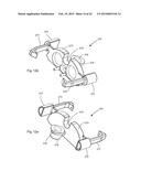 EXTENSIONLESS REVERSIBLE CONNECTION CATHETER APPARATUS diagram and image