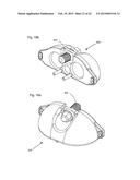 EXTENSIONLESS REVERSIBLE CONNECTION CATHETER APPARATUS diagram and image