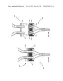 EXTENSIONLESS REVERSIBLE CONNECTION CATHETER APPARATUS diagram and image