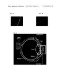 COMPOSITION AND METHOD FOR CORNEAL PROLIFERATION diagram and image