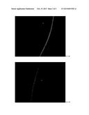 COMPOSITION AND METHOD FOR CORNEAL PROLIFERATION diagram and image