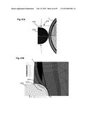 APPARATUS AND METHODS FOR OCULAR INJECTION diagram and image