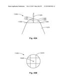 APPARATUS AND METHODS FOR OCULAR INJECTION diagram and image