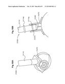 APPARATUS AND METHODS FOR OCULAR INJECTION diagram and image