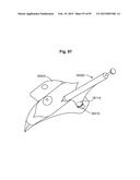 APPARATUS AND METHODS FOR OCULAR INJECTION diagram and image