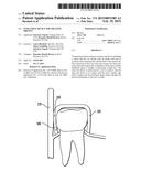 INTRA-ORAL DEVICE FOR TREATING OBESITY diagram and image