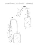 DRAINAGE CATHETER AND ASSEMBLY WITH ROTATIONAL FITTING AND METHODS OF USE diagram and image