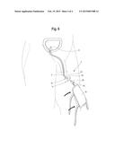 DRAINAGE CATHETER AND ASSEMBLY WITH ROTATIONAL FITTING AND METHODS OF USE diagram and image