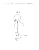 CAPSULE TYPE MEDICAL DEVICE AND MEDICAL SYSTEM diagram and image