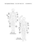 OVARIAN NEUROMODULATION AND ASSOCIATED SYSTEMS AND METHODS diagram and image