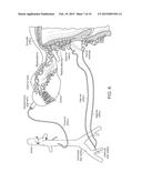 OVARIAN NEUROMODULATION AND ASSOCIATED SYSTEMS AND METHODS diagram and image