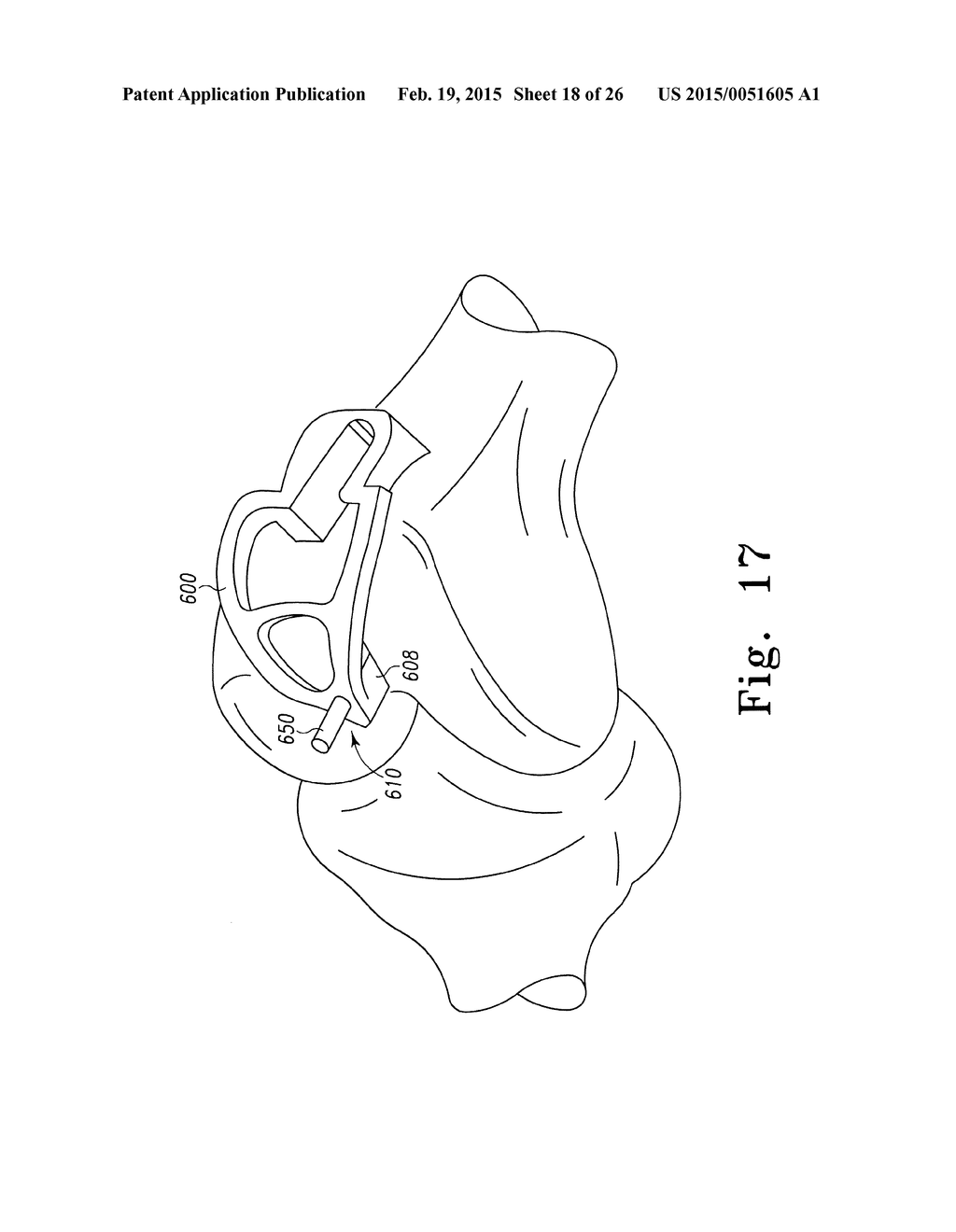 ORTHOPAEDIC SURGICAL INSTRUMENTATION FOR PERFORMING A PATELLOFEMORAL     ARTHROPLASTY PROCEDURE - diagram, schematic, and image 19