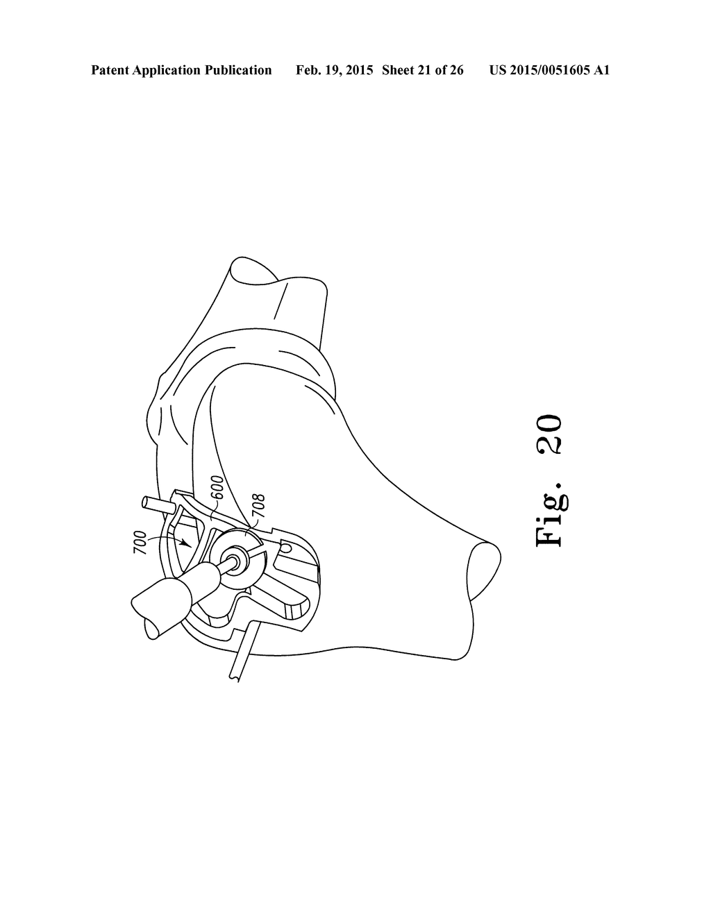 ORTHOPAEDIC SURGICAL INSTRUMENTATION FOR PERFORMING A PATELLOFEMORAL     ARTHROPLASTY PROCEDURE - diagram, schematic, and image 22