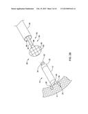 LEADLESS CARDIAC PACEMAKER AND RETRIEVAL DEVICE diagram and image