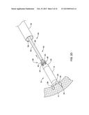 LEADLESS CARDIAC PACEMAKER AND RETRIEVAL DEVICE diagram and image