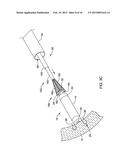 LEADLESS CARDIAC PACEMAKER AND RETRIEVAL DEVICE diagram and image