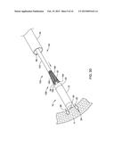 LEADLESS CARDIAC PACEMAKER AND RETRIEVAL DEVICE diagram and image