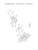 LEADLESS CARDIAC PACEMAKER AND RETRIEVAL DEVICE diagram and image