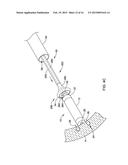 LEADLESS CARDIAC PACEMAKER AND RETRIEVAL DEVICE diagram and image