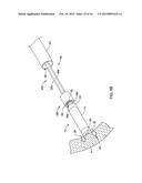 LEADLESS CARDIAC PACEMAKER AND RETRIEVAL DEVICE diagram and image