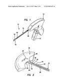 ARTHROSCOPIC MENISCAL REPAIR SYSTEMS AND METHODS diagram and image