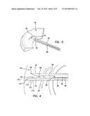 ARTHROSCOPIC MENISCAL REPAIR SYSTEMS AND METHODS diagram and image