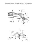 ARTHROSCOPIC MENISCAL REPAIR SYSTEMS AND METHODS diagram and image