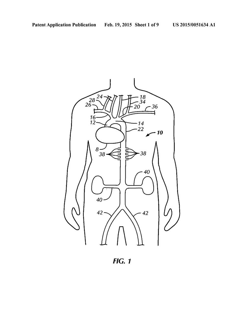 AORTIC OCCLUDER WITH TENSIONED BALLOONS - diagram, schematic, and image 02