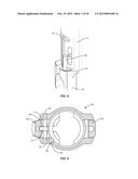 SPINAL IMPLANT SYSTEM AND METHOD diagram and image