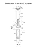 SPINAL IMPLANT SYSTEM AND METHOD diagram and image