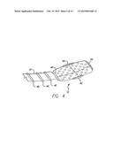 Flexible Circuit Electrode Array for Improved Layer Adhesion diagram and image