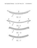 Flexible Circuit Electrode Array for Improved Layer Adhesion diagram and image