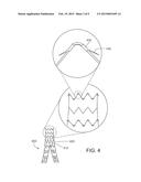 MEDICAL DEVICE FIXATION ANCHORS diagram and image