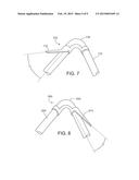 MEDICAL DEVICE FIXATION ANCHORS diagram and image