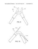 MEDICAL DEVICE FIXATION ANCHORS diagram and image