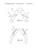 MEDICAL DEVICE FIXATION ANCHORS diagram and image