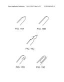 MEDICAL DEVICE FIXATION ANCHORS diagram and image