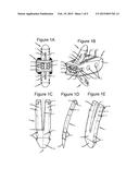 ANCHORING DEVICE AND SYSTEM FOR AN INTERVERTEBRAL IMPLANT, INTERVERTEBRAL     IMPLANT AND IMPLANTATION INSTRUMENT diagram and image