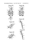 ANCHORING DEVICE AND SYSTEM FOR AN INTERVERTEBRAL IMPLANT, INTERVERTEBRAL     IMPLANT AND IMPLANTATION INSTRUMENT diagram and image