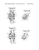 ANCHORING DEVICE AND SYSTEM FOR AN INTERVERTEBRAL IMPLANT, INTERVERTEBRAL     IMPLANT AND IMPLANTATION INSTRUMENT diagram and image