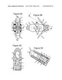 ANCHORING DEVICE AND SYSTEM FOR AN INTERVERTEBRAL IMPLANT, INTERVERTEBRAL     IMPLANT AND IMPLANTATION INSTRUMENT diagram and image