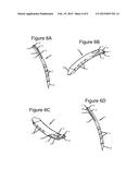 ANCHORING DEVICE AND SYSTEM FOR AN INTERVERTEBRAL IMPLANT, INTERVERTEBRAL     IMPLANT AND IMPLANTATION INSTRUMENT diagram and image